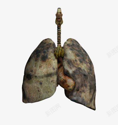 吸烟人的肺png免抠素材_新图网 https://ixintu.com 亚健康 变色 斑驳