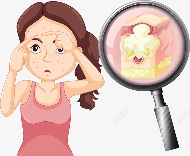 皮肤问题的女士矢量图eps免抠素材_新图网 https://ixintu.com 堵塞 毛孔 毛孔堵塞 皮肤 皮肤表皮 皮肤问题 矢量图 问题png