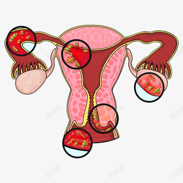 妇科病毒png免抠素材_新图网 https://ixintu.com 卡通病毒 妇科 病毒 矢量卡通病毒 矢量病毒