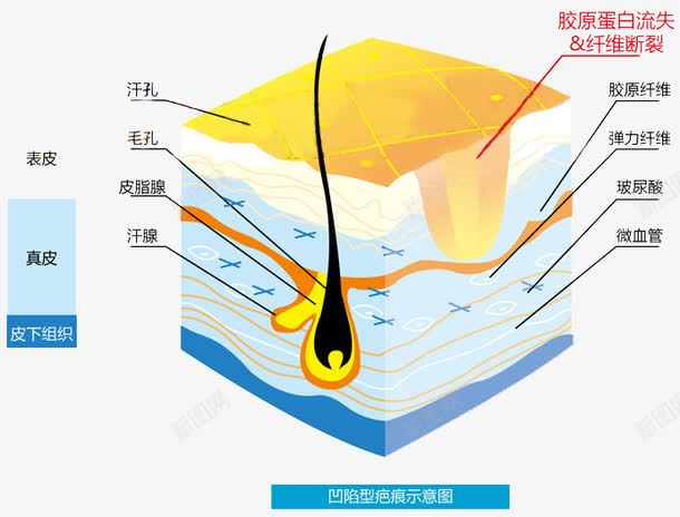 生活常识皮肤结构png免抠素材_新图网 https://ixintu.com 深层皮肤 皮肤 皮肤结构 组织 面部皮肤结构