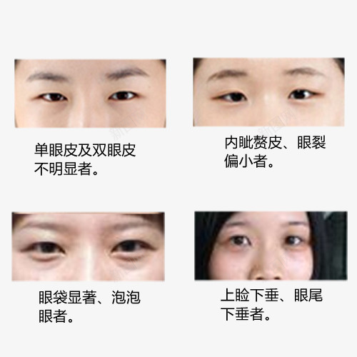 整形美容眼部实物图展示psd免抠素材_新图网 https://ixintu.com 各种眼部实物图 女性 完美眼部 实物图 微整 整形 整形专题 美容