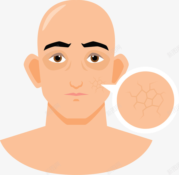 皮肤干裂卡通男人png免抠素材_新图网 https://ixintu.com SPA 卡通男人 护肤 皮肤去皱 皮肤干裂 皮肤表皮 美丽 美妆 美容院