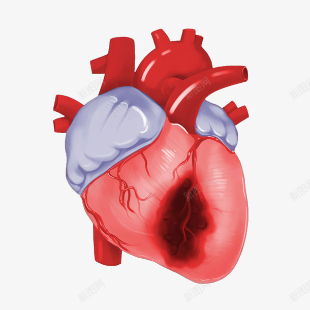 心脏疾病卡通插画png免抠素材_新图网 https://ixintu.com 免抠PNG 医疗 器官 心 心脏疾病卡通插画 感染 横断面 痛苦 身体部位