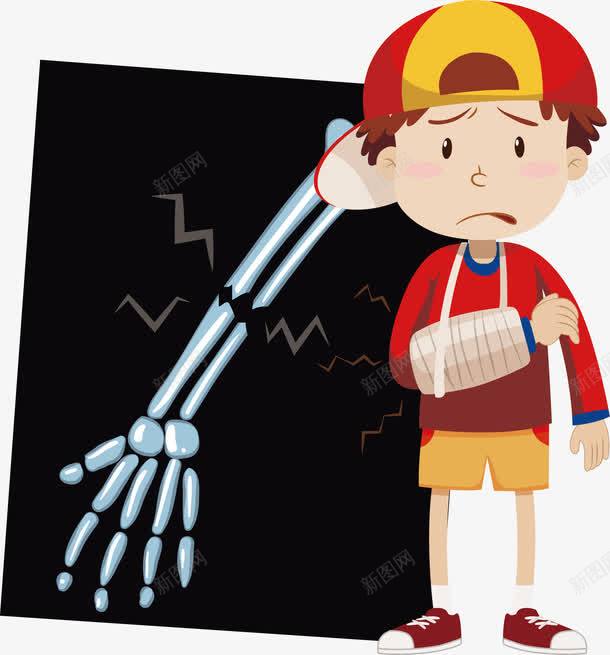 手臂骨折png免抠素材_新图网 https://ixintu.com X光片 拍片子 骨折