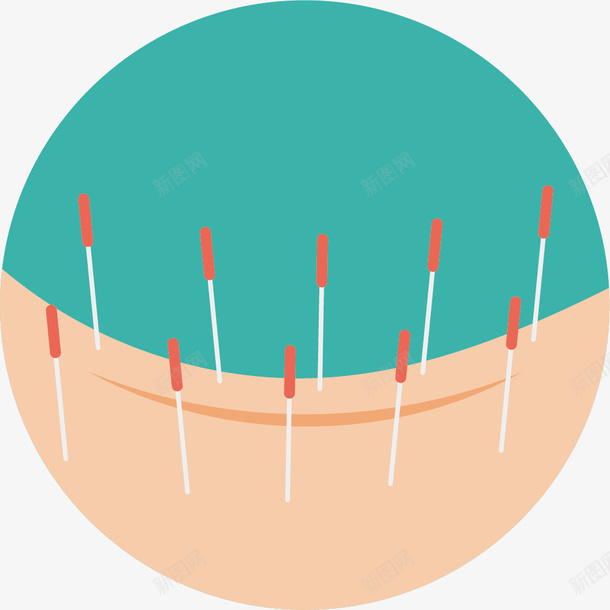 背部卡通针灸png免抠素材_新图网 https://ixintu.com 中医 中国针灸 卡通 扁平风格 背部 背部针灸 针灸疗法