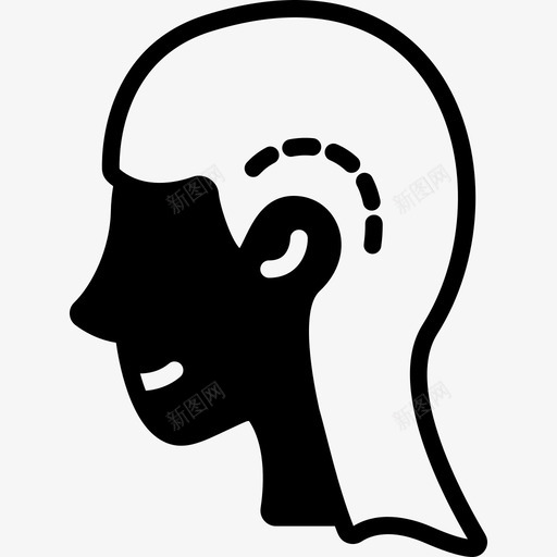耳成形术整形手术41填充物图标svg_新图网 https://ixintu.com 填充 成形术 手术 整形