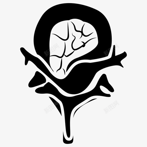 脑脊髓神经系统神经学图标svg_新图网 https://ixintu.com 人工 假体 医用 植入物 神经元 神经学 神经系统 脊髓 脑脊髓 解剖学 骨科
