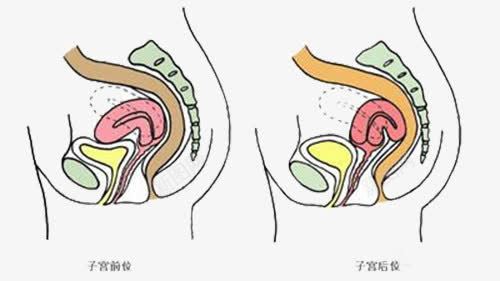子宫位图png免抠素材_新图网 https://ixintu.com 位图 医学 子宫 生理 装饰