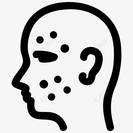 皮肤科痤疮过敏svg_新图网 https://ixintu.com 皮肤 皮肤科 痤疮 过敏 问题 治疗 医疗保健 字形 2部