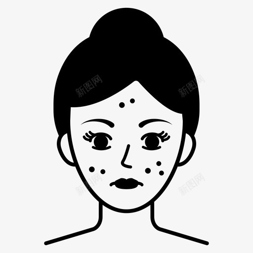 痤疮美容面部皮疹svg_新图网 https://ixintu.com 痤疮 美容 面部 皮疹 皮肤 问题 美女