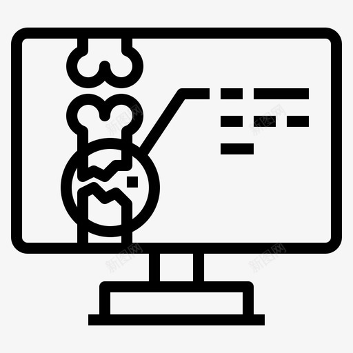 x光骨头骨折svg_新图网 https://ixintu.com 光光 骨头 骨折 电脑 健康 医院 医疗