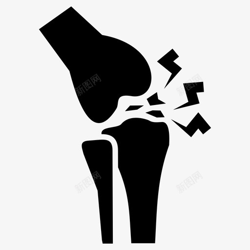 骨关节解剖学人体svg_新图网 https://ixintu.com 骨关节 人体 解剖学 医学
