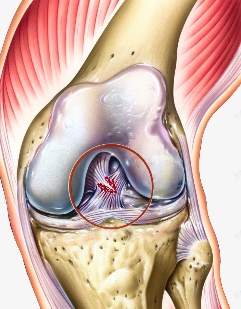 膝盖结构医学插图png免抠素材_新图网 https://ixintu.com 医学插图 半月板 腿疼 膝盖 骨髓