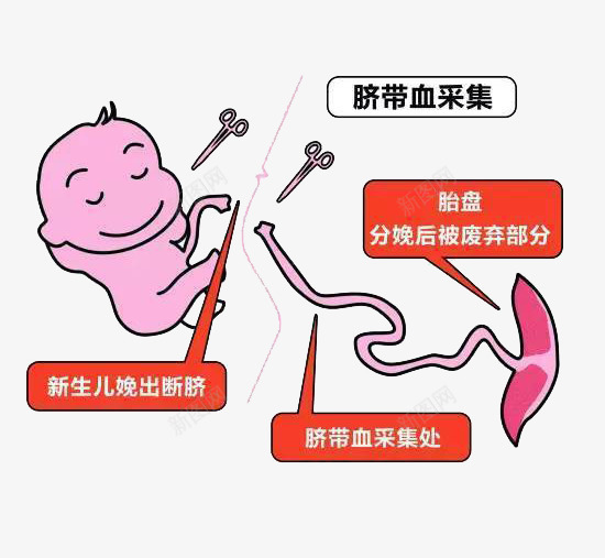 剪掉新生儿的脐带png免抠素材_新图网 https://ixintu.com 出生 婴儿 宝宝 小娃娃 新生儿 母婴 胎儿 胚胎 脐带 脐带血 诞生 降临