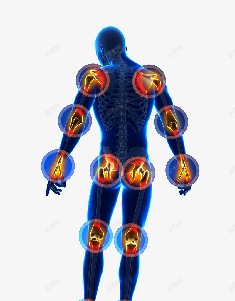 人体关节疼痛png免抠素材_新图网 https://ixintu.com 人体关节 人体工作 关节 关节炎 关节疼痛 生病病痛