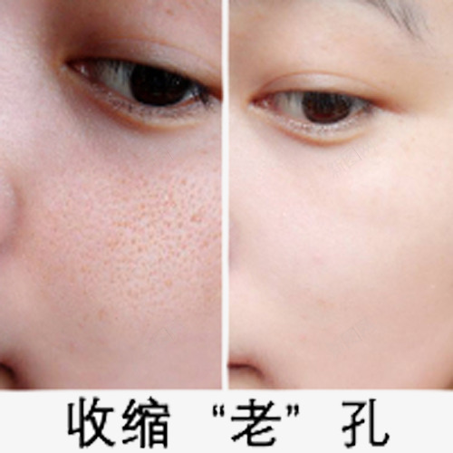 毛孔粗大png免抠素材_新图网 https://ixintu.com 化妆 收缩 毛孔 毛孔粗大 美容