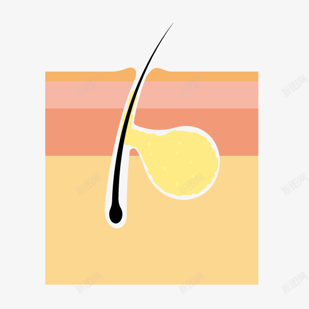 卡通毛囊发炎png免抠素材_新图网 https://ixintu.com 医学图示 卡通毛囊 卡通生物课 毛囊炎 皮肤问题