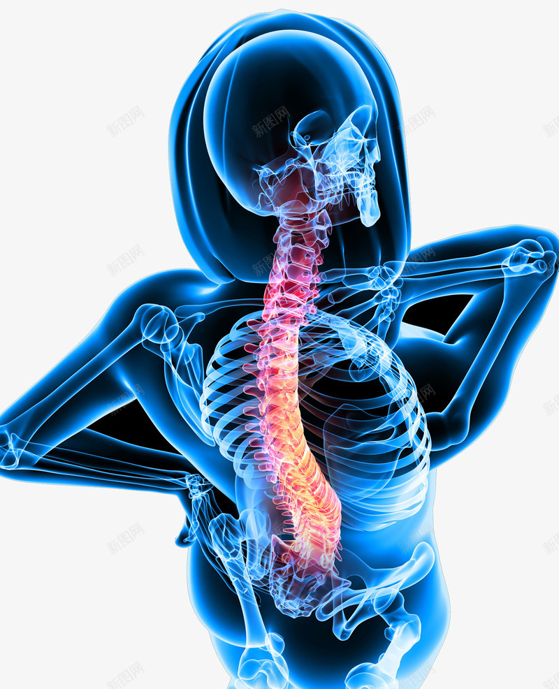 腰椎疼痛png免抠素材_新图网 https://ixintu.com 炎症 脊柱 腰椎 风湿病