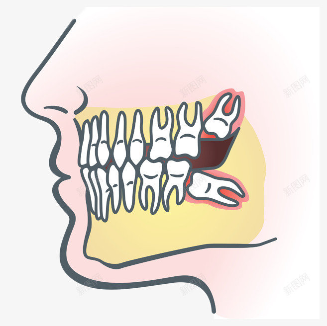 卡通头像牙齿智齿图示插画png免抠素材_新图网 https://ixintu.com 医学 卡通 图示 头像 插画 智齿 牙医 牙科 牙齿 牙齿修护卡通图