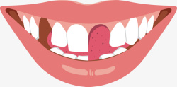 一排牙齿缺损蛀牙嘴唇高清图片