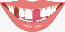 缺损缺损蛀牙嘴唇高清图片