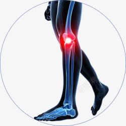 矢量人物病痛治疗膝盖骨关节手绘图高清图片