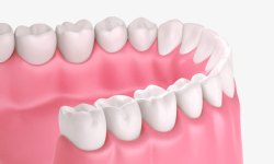 手拿牙齿模型模型牙齿高清图片