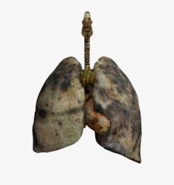 亚健康吸烟人的肺高清图片