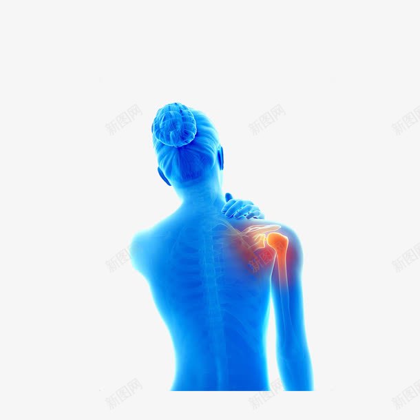 立体肩膀痛的X光下的女士png免抠素材_新图网 https://ixintu.com X光下的女士 生病病痛 红色疼痛区 肩周炎 蓝色 颈肩腰腿痛