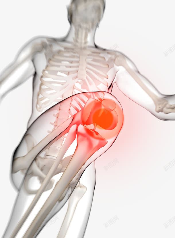 膝盖骨头红肿发炎png图片免费下载 素材7qjwvuwkq 新图网