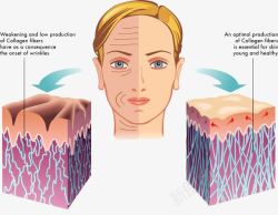 皮肤结构图人物皮肤结构图高清图片