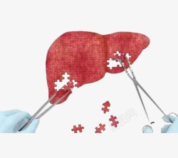 肝炎肝脏拼图高清图片