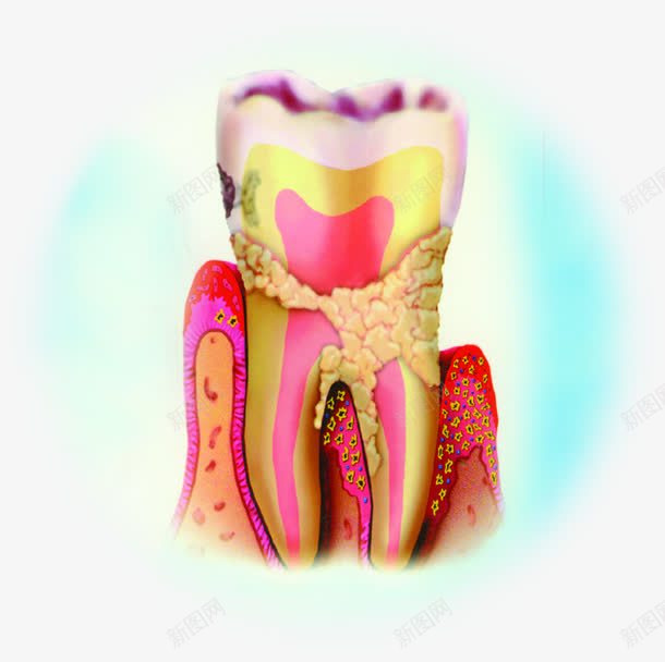 蛀牙牙科展板png免抠素材_新图网 https://ixintu.com 图片 展板 牙科
