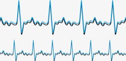 心电向量图频率一样的心率图高清图片
