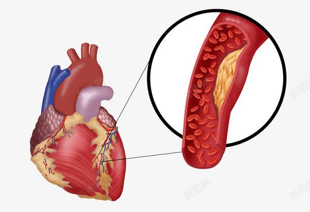 心脏血管png免抠素材_新图网 https://ixintu.com 大动脉 心血管 血小板 血液循环