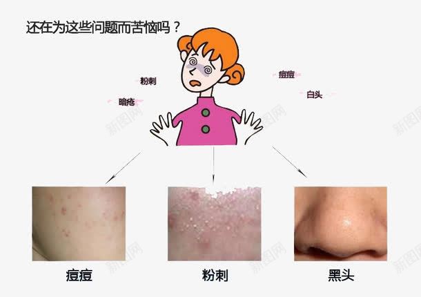 别挤痘痘png免抠素材_新图网 https://ixintu.com 卡通痘痘 挤痘痘 烦恼 痘痘 美女 黑头