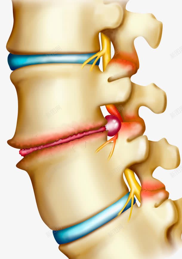 骨头关节神经png免抠素材_新图网 https://ixintu.com 关节炎 炎症 神经 骨头关节