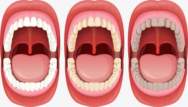 口腔牙齿健康问题矢量图ai免抠素材_新图网 https://ixintu.com 口腔 口腔健康 牙齿 牙齿健康 牙齿变黄 矢量png 矢量图