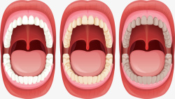 牙齿变黄口腔牙齿健康问题矢量图高清图片