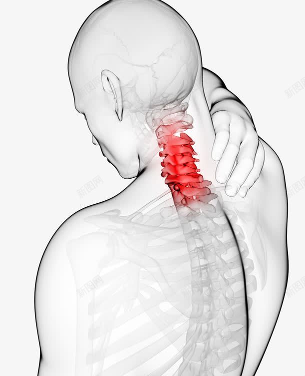 肩周炎png免抠素材_新图网 https://ixintu.com 医疗插图 炎症 疼痛 腰椎