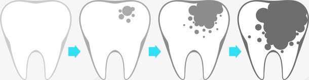 龋齿演变图标png_新图网 https://ixintu.com 图标icon 演变 牙科 牙齿 蛀牙 龋齿
