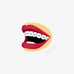 露牙齿的女人卡通戴牙套红唇开心微笑插画高清图片