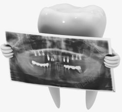 X光透视片牙齿X光透视片高清图片