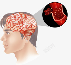 透视的大脑人类大脑血管分析图矢量图高清图片
