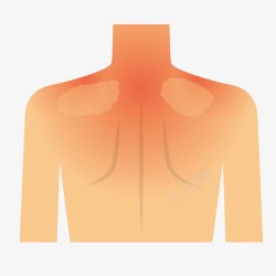 人体疾病卡通颈椎肩周病高清图片