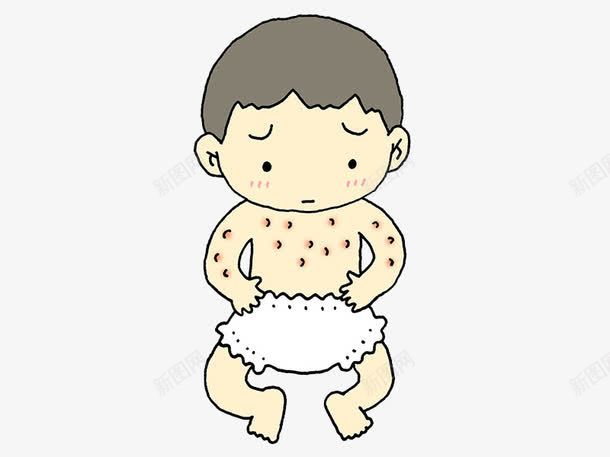 婴儿皮肤过敏png免抠素材_新图网 https://ixintu.com 医疗 卡通手绘 宣传 广告 湿疹 皮肤过敏 装饰