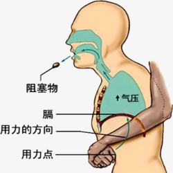 喉咙被阻塞嗓子被卡急救方法高清图片