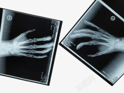 X射线X光透视片高清图片