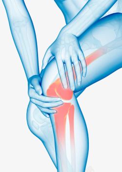 X光报告膝盖骨折高清图片