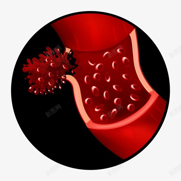 医疗红色细胞壁矢量图ai免抠素材_新图网 https://ixintu.com 卡通 心脑血管 病毒 细胞体 脑出血 血管 血管壁 矢量图